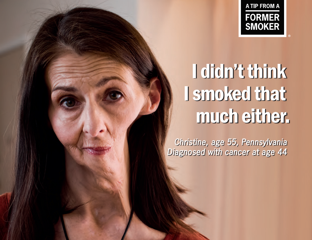 Christine smoked, but she exercised and ate healthy foods and never thought her smoking would hurt her. Christine reveals that she lost her teeth and half of her jaw due to cancer.